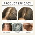 thumbnail image 5 of Aceite esencial para la densidad capilar natural, suero de jengibre para el recrecimiento del cabello durante 7 días, suero para la caída del cabello, 30 ml., 5 of 5