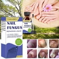 thumbnail image 5 of Fungal Nail Treatment - 30ml Extra Strong Nail Fungus Treatment for Toenail - Anti Fungus Nail Repair and Strengthen, 5 of 5