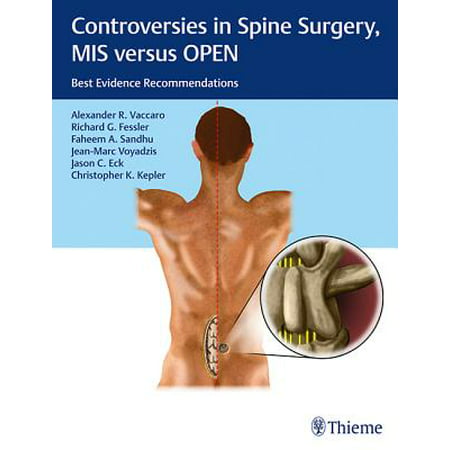 Controversies in Spine Surgery, MIS Versus Open : Best Evidence (Best Evidence Rule New York)