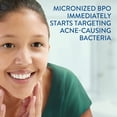 thumbnail image 4 of Limpiador Cetaphil Gentle Clear Complexion con 2,6% de BPO 125 ml, 4 of 9