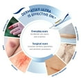 thumbnail image 2 of Clearance! Dermatix Silicone Gel Clinically Scar for All Skin Types Options Sky Blue, 2 of 8