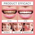 thumbnail image 5 of Sp 9 Toothpaste SP-9 Probiotic Toothpaste Sp9 Pasta Dental Teeth Whitening Care Toothpaste Stain Removal Deep Cleaning Fresh Breath--1pc, 5 of 5