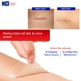 thumbnail image 7 of Gauze Care Silicone Scar Tape, 1.6" x 60" Roll – Medical-Grade Reusable First Aid Tape for Surgery, C-Section, Burns, Keloids, and Acne, 7 of 7