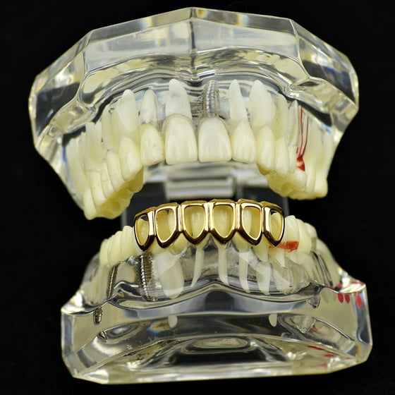 Best Grillz 14k Gold Plated 6 Open Face Grillz Six Tooth Lower Row