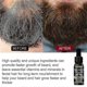 thumbnail image 2 of Beard Growth Oil Firming Moisturizing Spray Beard Care To Promote Beard Growth Dense Liquid -, 2 of 3