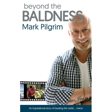 Beyond the Baldness - eBook