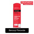 thumbnail image 1 of Neutrogena Traitement AM Acné tenace - Poussée d'acné, Peroxyde de benzoyle, Sans parfum, 1 of 9