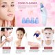 thumbnail image 2 of Limpiador de poros Eliminación de espinillas Aspiración al vacío Acné Limpiador de grasa para espinillas Cuidado de la piel facial Blanco, 2 of 8