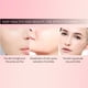 thumbnail image 2 of Crema para eliminar pecas, antienvejecimiento, elimina las manchas oscuras, melasma, aclara el cuidado de la piel Ndcxsfigh Cuidado Belleza, 2 of 8