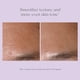 thumbnail image 5 of Set de inicio EXUVIANCE Performance Peel AP25 Chemical Peel, 5 of 9