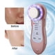 thumbnail image 3 of 5 en 1 Masajeador de Máquina de Belleza de Cara del Instrumento del Rejuvenecimiento de Salida de Piel (Oro) EOTVIA No, 3 of 6