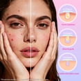 thumbnail image 4 of Pimple Patches for Face, Hydrocolloid Acne Patches, Colorful Superstar Patches Spot Stickers, Cute Star Zit Covers, 357 Count | 4 Sizes (8mm/9mm/11mm/14mm), 4 of 8