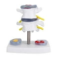 thumbnail image 4 of Modelo de Hernia de Disco Lumbar Anatómico Humano, Suministros de Entrenamiento para la Escuela de la Columna Vertebral Humana, Excelente Manera de Demostrar el Disco Saludable Crtynell NO, 4 of 7