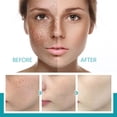 thumbnail image 5 of Suero de Niacinamida con Niacinamida Retinol Ácido Hialurónico y Ácido Salicílico kaili Sencillez, 5 of 5