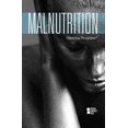 thumbnail image 1 of Malnutrition (Opposing Viewpoints (Paperback)), 1 of 1