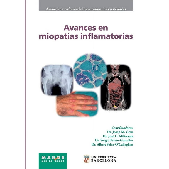 Avances en miopatÃ­as inflamatorias, (Paperback)