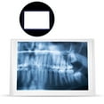 thumbnail image 1 of Boîte de Visualisation LED pour Film, Panneau Lumineux LED pour Dentiste à Domicile, 1 of 8