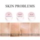 thumbnail image 1 of Mascarilla facial de arcilla Mascarilla facial de barro de arcilla antienvejecimiento Productos para el cuidado de la belleza (Sakura) Likrtyny Cuidado Belleza, 1 of 9