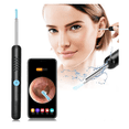 thumbnail image 1 of Otoscopio, Otoscopio de oído, cámara de oído 1080P, eliminación de cerumen Aibast, endoscopio de oído, 6 luces LED, adecuado para teléfonos inteligentes como iPhone, iPad y Android, 1 of 5