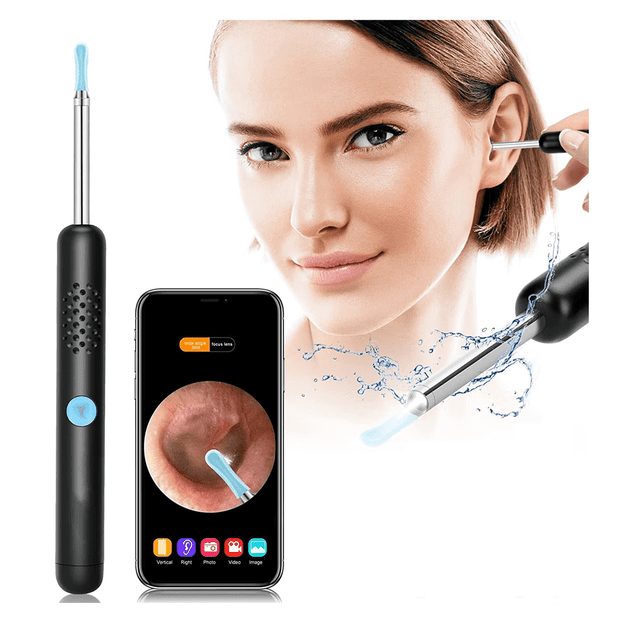 Otoscopio, Otoscopio de oído, cámara de oído 1080P, eliminación de cerumen Aibast, endoscopio de oído, 6 luces LED, adecuado para teléfonos inteligentes como iPhone, iPad y Android