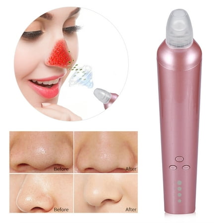 Yosoo Electric LED Facial Pore Cleanser Face Blackhead Acne Removal Skin Cleaner Device Skin Firming