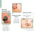 thumbnail image 3 of Back Acne Treatment Spray, 3 of 5