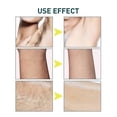 thumbnail image 2 of Hair Removal Wax Set, Body Gentle Does Not Stimulate Clean Hair Removal Wax Set, 2 of 5