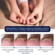 thumbnail image 2 of Líquido reparador de uñas de 10 ml Líquido eficaz para uñas Multiusos para el cuidado de los pies Ygjytge Cuidado Belleza, 2 of 8