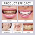 thumbnail image 5 of Teeth Whitening Strips | Home Teeth Whitening Strips, 5 of 5