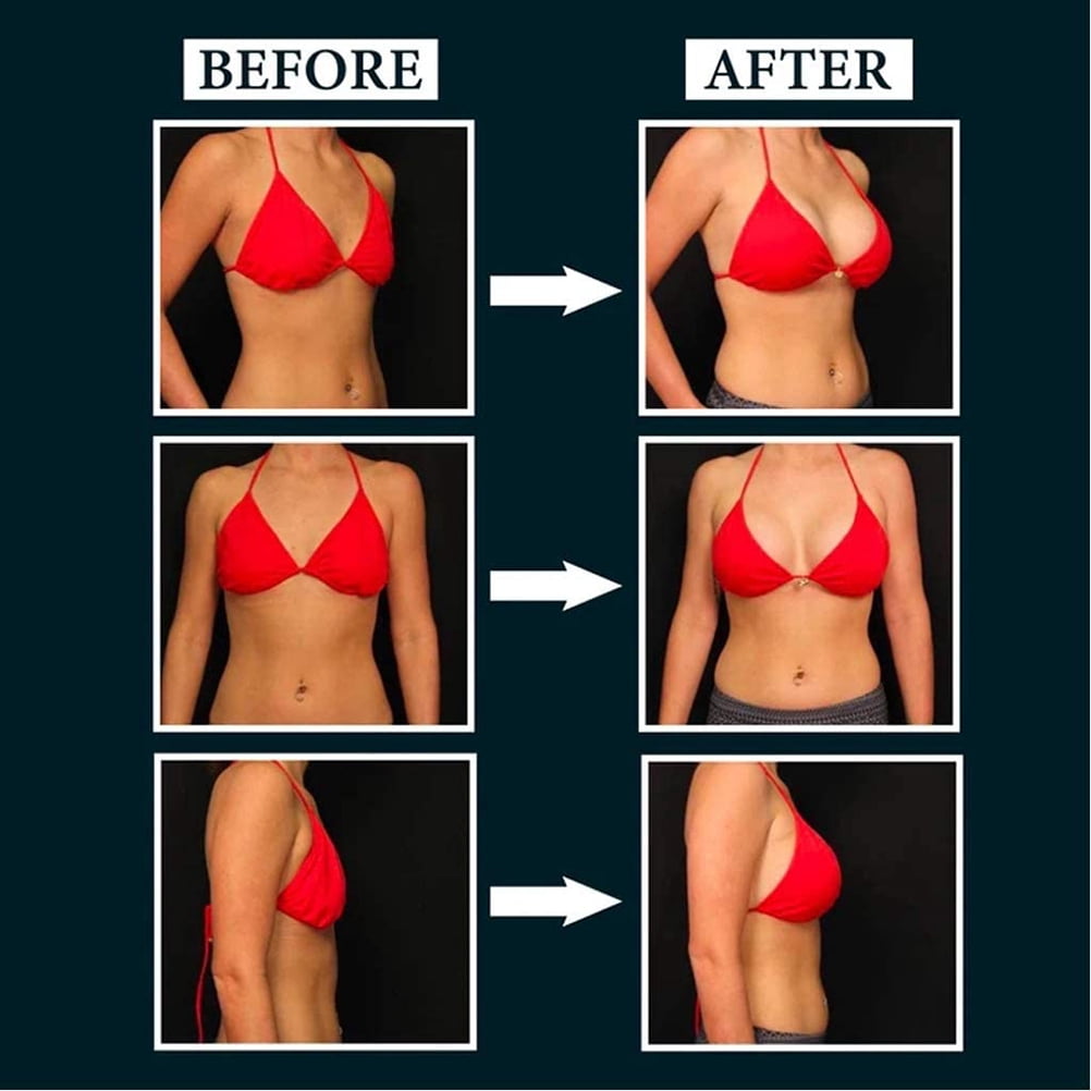 FitBest Electric Breast Massage Pad Electric Breast Massager Chest