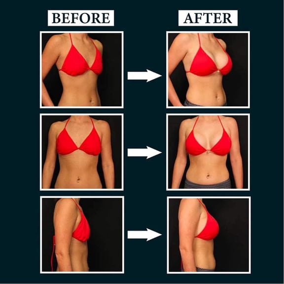 FitBest Electric Breast Massage Pad Electric Breast Massager Chest Frequency Vibration Massager