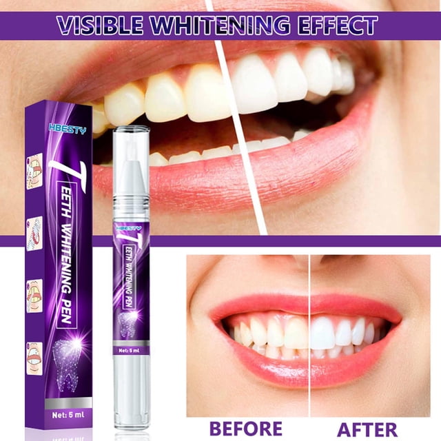 Pasta dental de 5 ml para eliminar eficazmente las manchas amarillas de los dientes.