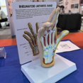 thumbnail image 3 of Modelo de Mano de Osteoartritis, Modelo de Patología de la Mano, Réplica de Anatomía y Fisiología , Modelo de Anatomía del Consultorio, 3 of 5