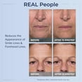 thumbnail image 4 of PlexadmRapid Reduction Eye Serum 5 ML Advanced Formula Anti Aging Eye Serum Reduces Under Eye Bags Wrinkles Dark Circles Fine Lines Crow's Feet Instantly Instant Wrinkle Remover for Youthful Look, 4 of 8