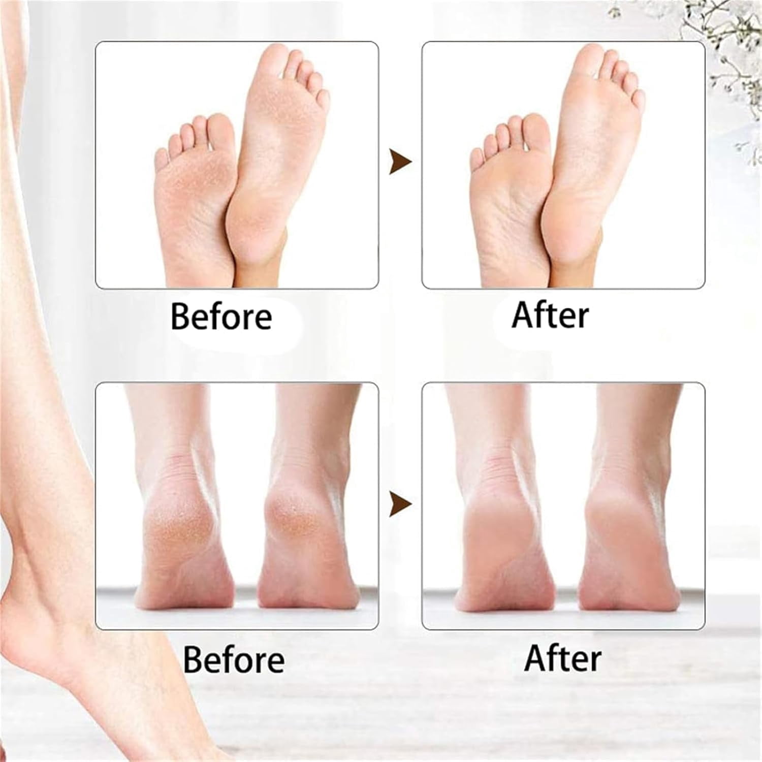 Onwddarefy Electric Feet Callus Remover, 360 Rotation Callus Remover for Feet, 3 Speeds Adjustable, for Women and Men Cracked (Gold)