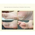 BONINGGG 1Pair Exfoliating Peel Foot Baby Soft Feet Hard Dead Skin