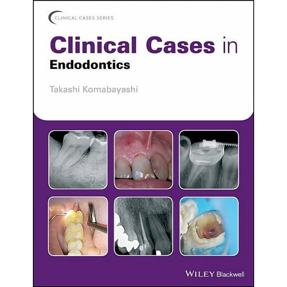 Clinical Cases (Dentistry) Clinical Cases in Endodontics, (Paperback)