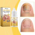 thumbnail image 1 of Bee Venom Fungal Nail Treatment for Toenail Extra Strong, Nail Fungus Solution, Anti Toe Toenail Nail Fungal Solution for Ingrown Toenail Treatment, 1 of 4
