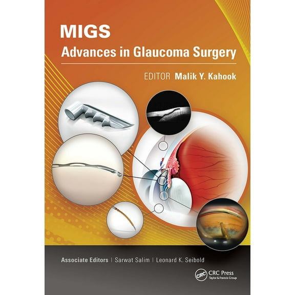 Migs: Advances in Glaucoma Surgery, (Paperback)
