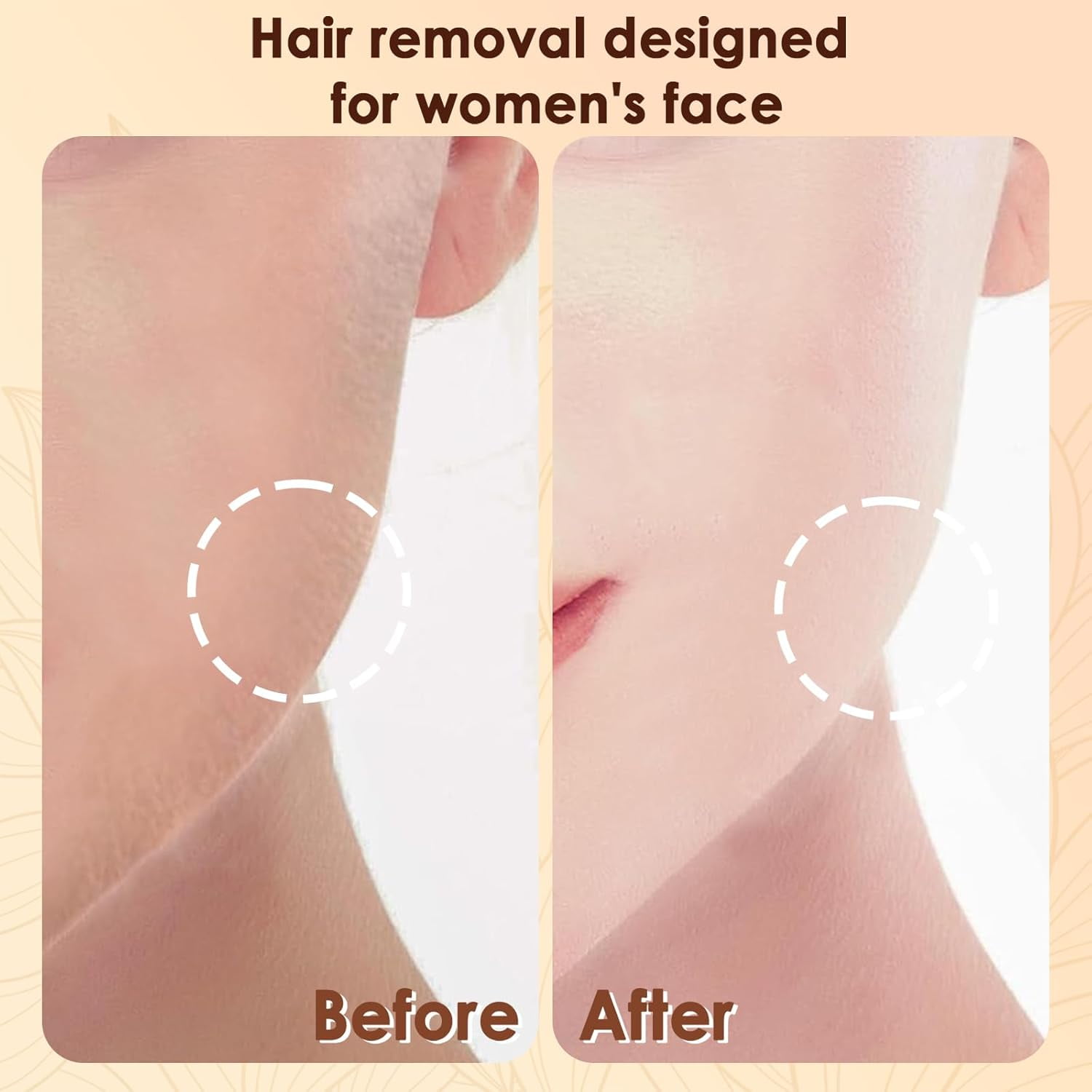 Facial Hair Removal for Women(Gen 3 Pro), SEIHAI Facial Hair Remover, Luxury Hair Removal Device for Face, Eyebrow, Peach Fuzz, with 2 Flawless Replacement Heads
