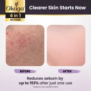 Okaga Black Rice Peel Shot Ampoule, Black Rice Exfoliant Soft Exfoliating Face Peel, Dead Skin, Rice Exfoliator for Face, Pore Minimizer Hydrating Formula for Smooth Radiant Skin, All Skin Types 90mL