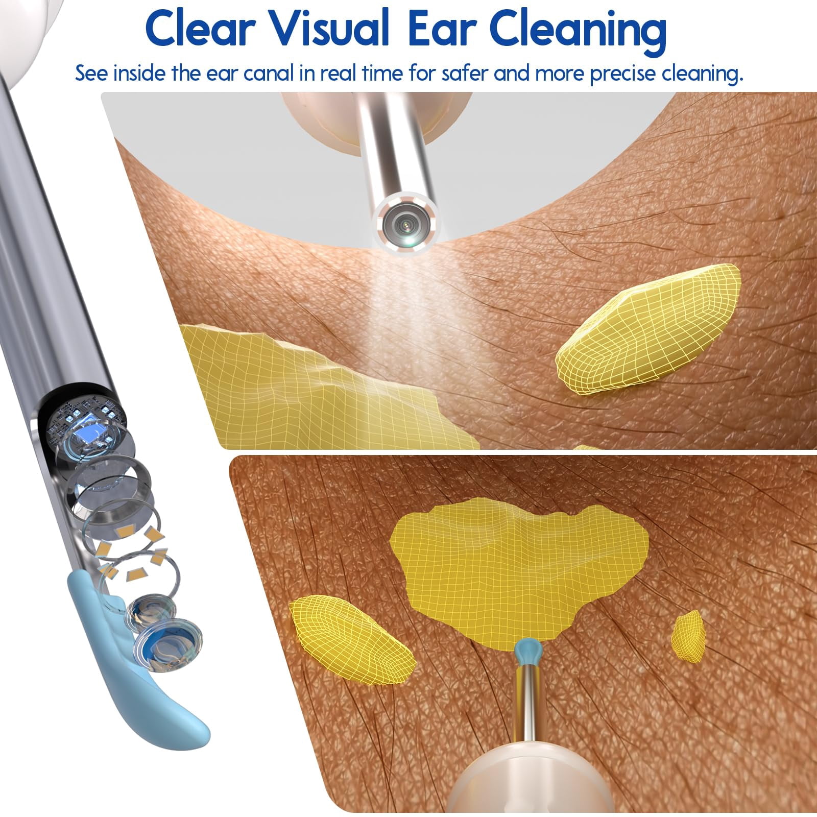 Ear Cleaner with Camera, Wireless Ear Wax Removal Tool with Screen, Visual Ear Cleaner Kit with Tweezers and Replacement Tips, Safe Ear Cleaning Tool for Kids & Adults