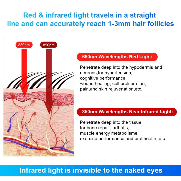 Hair Loss: There's a (Red) Light at the End of the Tunnel