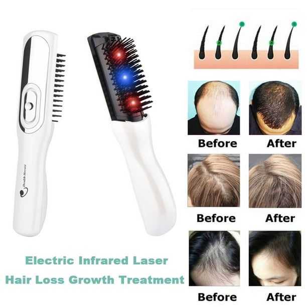 Electric Laser Hair Growth Comb Anti Hair Loss Massage Therapy Infrared Red  Light Ions Vibration Massager Brush Buy Hair Growth Comb,Vibration Massager  Brush,Electric Hair Massage Comb Product On | Electric Infrared Laser