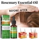 thumbnail image 4 of Rosemary Hair Care Essential Oil for Gentle Care of Scalp, Smooth and Glossy, Natural Fluffy Hair Care Essential Oil, 4 of 5