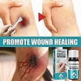 thumbnail image 5 of Liquid Skin Adhesive for Body Wounds, Fast-Drying Medical Bandage Solution, 5 of 5