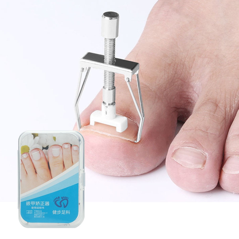 OTVIAP Ingrown Toenail Fixer Adjustable Toe Nail Paronychia Corrector Pedicure Care Tool Set , Toenail Corrector, Toe Nail Correction Tool