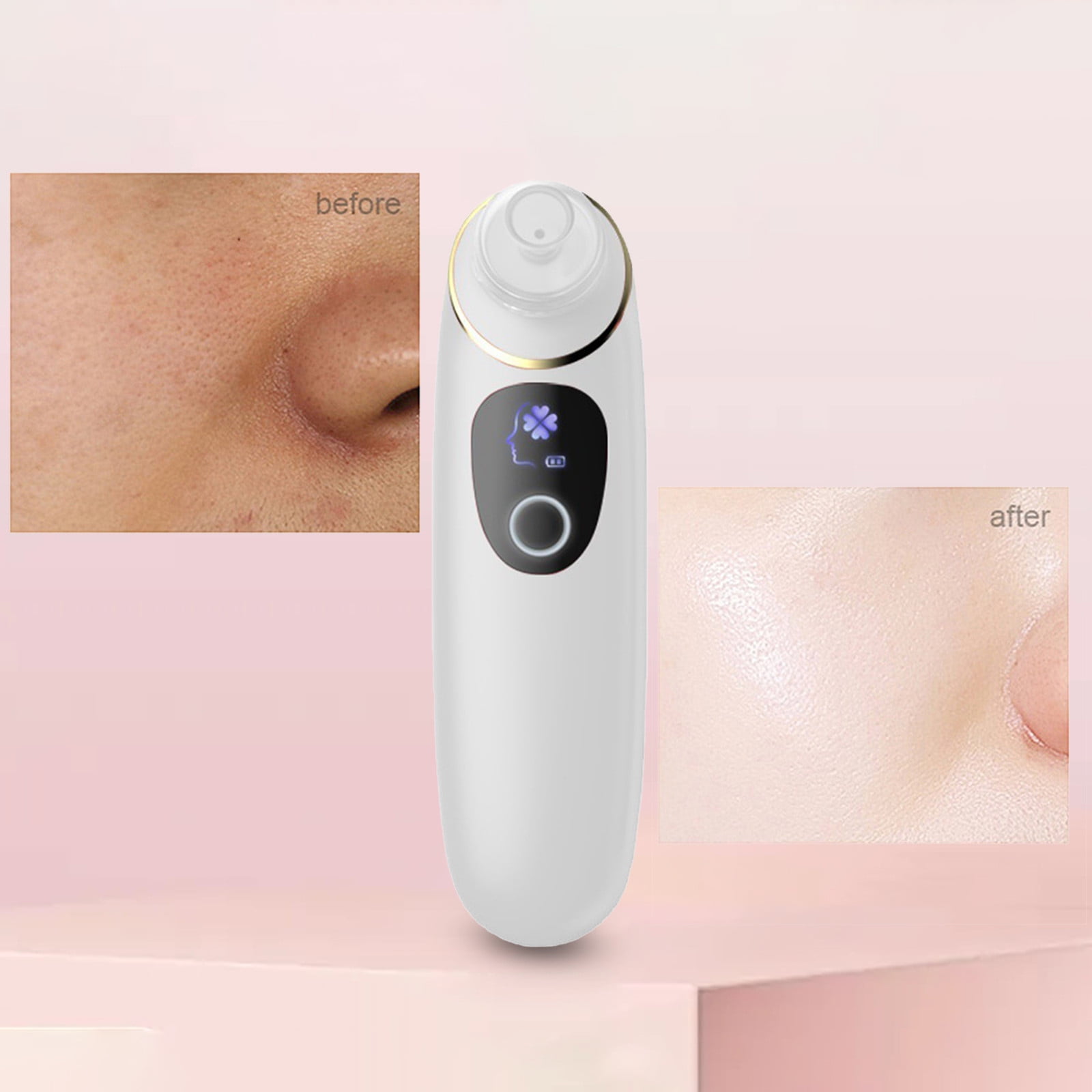 Beauty Instrument Pore Vacuum with Camera USB Rechargeable Blackhead Remover Vacuum 3 Adjustable Modes Face Vacuum Pore Cleanser for Women