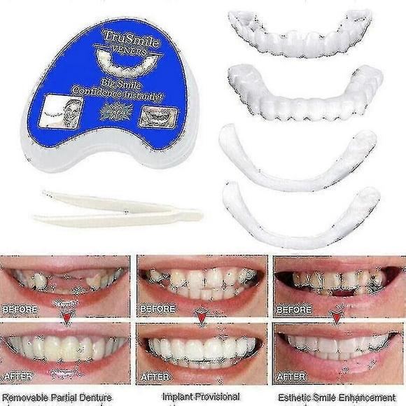Smile Snap On Teeth Upper Lower Dental Veneers Dentures Tooth Cover Set