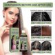 thumbnail image 3 of 1-3x 100ml Herbal Hair Oil Refreshing Non-greasy Essential Oil For Hair Growth Nourishes Scalp And Stimulates Hair Growth, 3 of 5